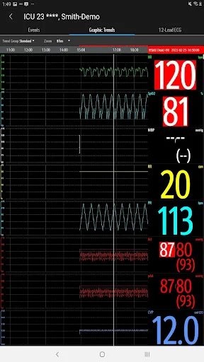 I-download ang Mindray Mobile Viewer – Real-time Monitoring App - Screenshot 23
